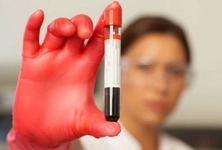 Mch Hemogram Düşüklüğü ve Yüksekliği