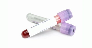 Hemogram Mono Nedir?