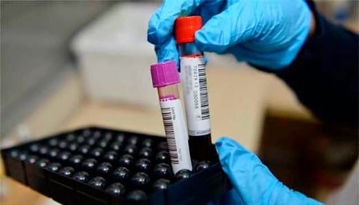 Hemogram Kan Değerleri Nedir ve Kaç Olmalıdır?