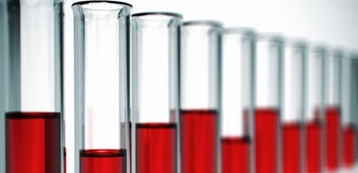 Hemogram Ly Normal Değeri