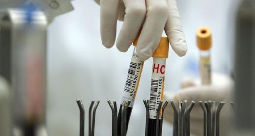 Hemogram Mch Yüksekliği Nedenleri?