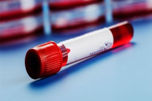 Hemogram Rbc Nasıl Yapılır?