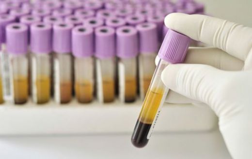 Hemogram Testi Nedir ve Nasıl Yapılır?