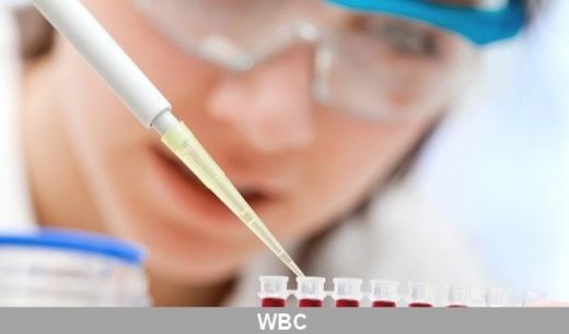 Hemogram Wbc Düşüklüğü ve Yüksekliği